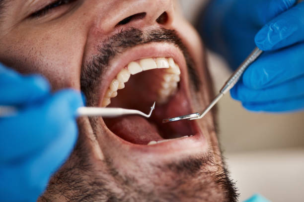 Best Same-Day Emergency Dental Services in Bartlett, TX