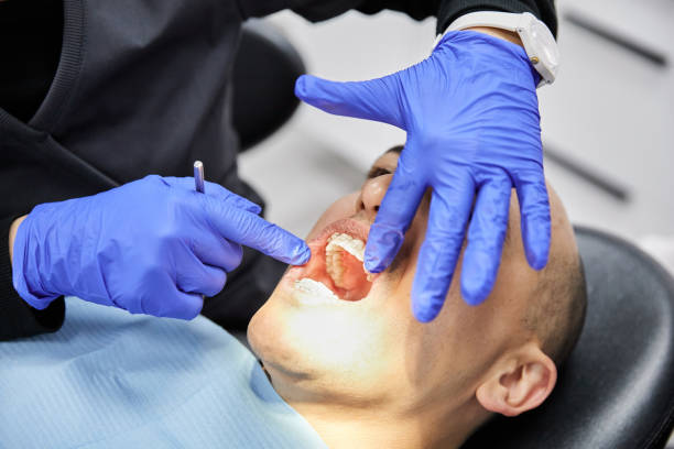 Best Emergency Root Canal Treatment in Bartlett, TX